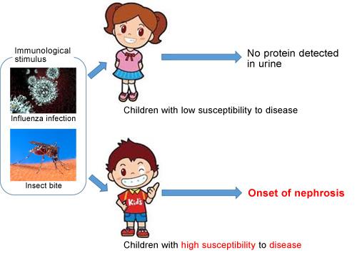 図１．小児ステロイド感受性ネフローゼ症候群の発症機序仮説
