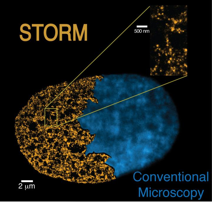 STORM Image vs. Conventional Microscopes Image