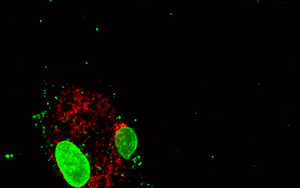 Human macrophage, University of California San Diego