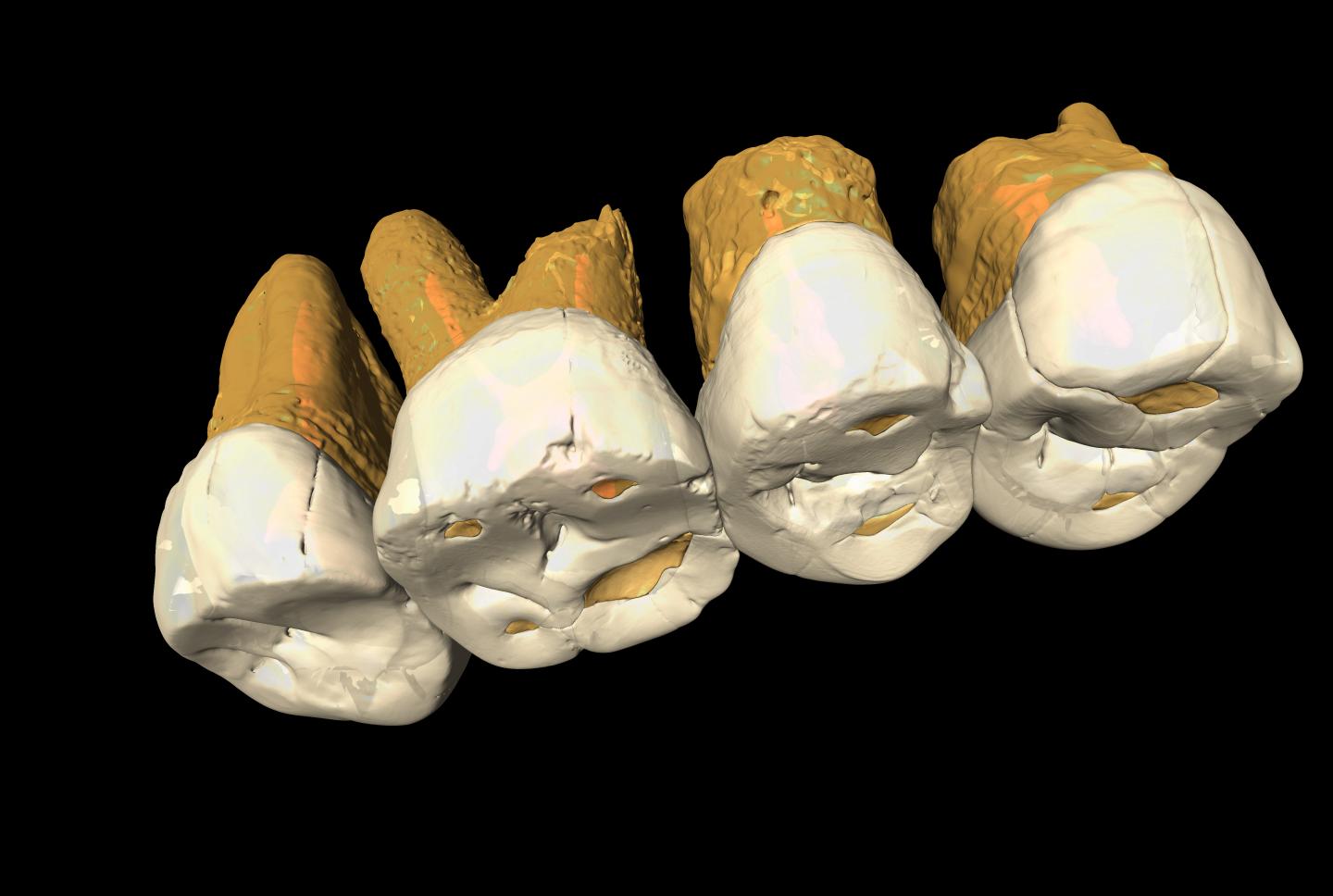 CT Scan 