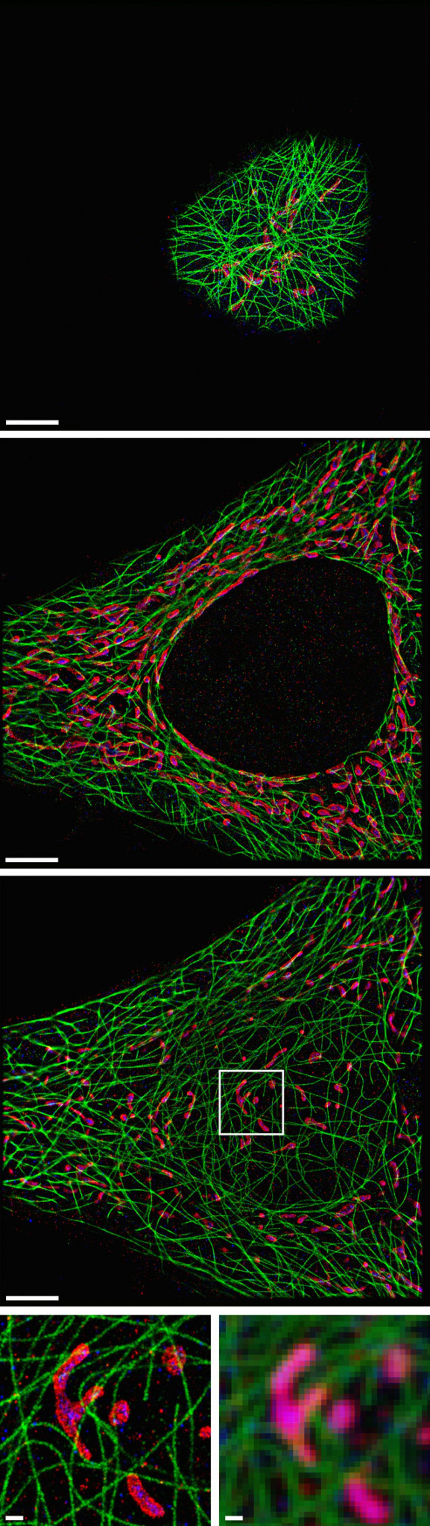 Super-Resolution Whole-Cell Imaging with Spinning Disc Confocal Microscopes