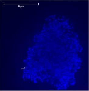 A microscopic picture of a methanogen