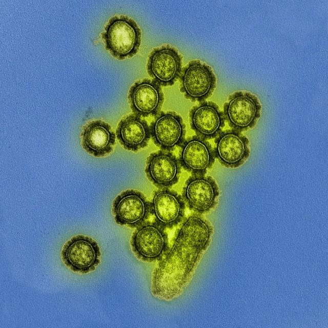 H1N1 Influenza Virus Particles