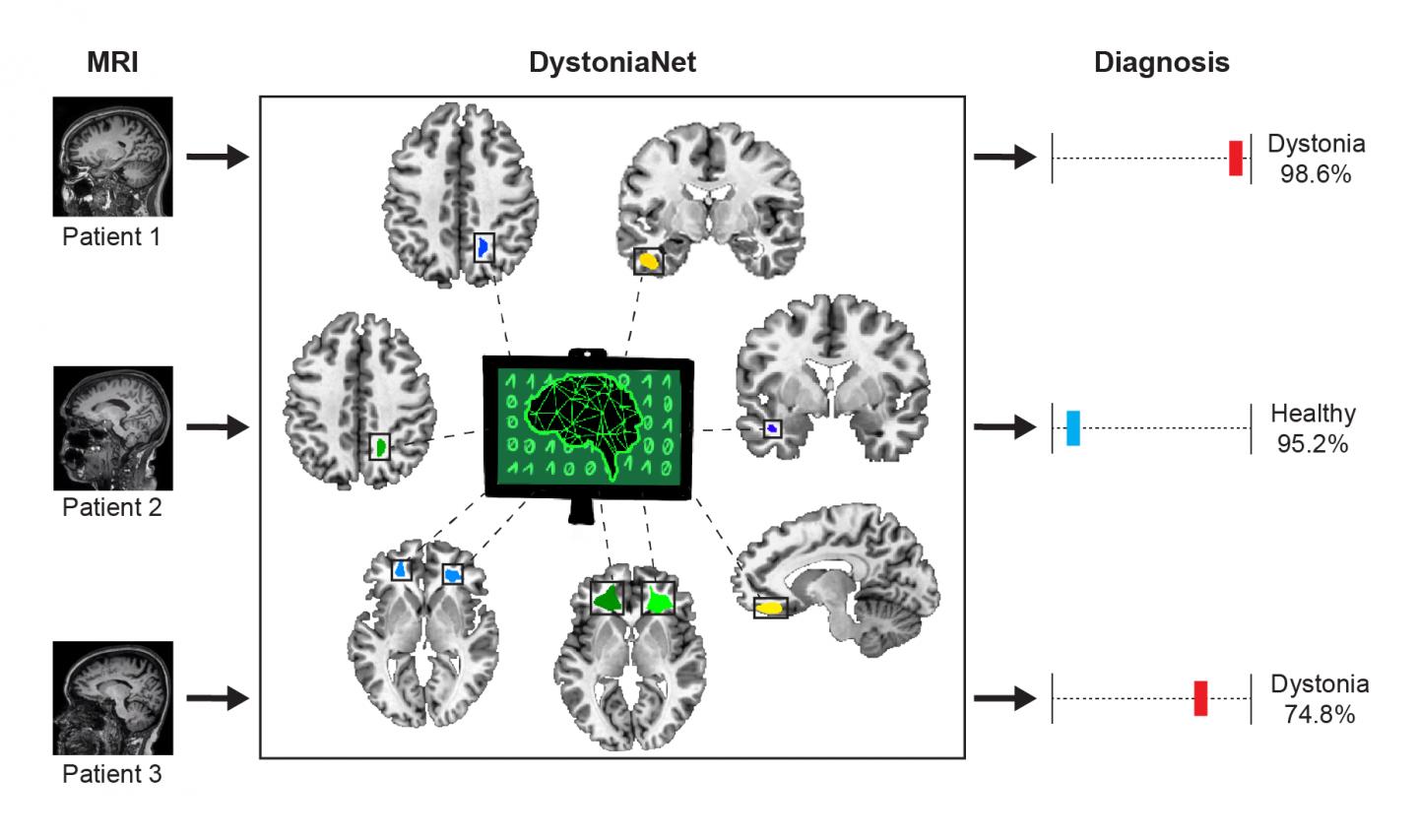 DystoniaNet Process