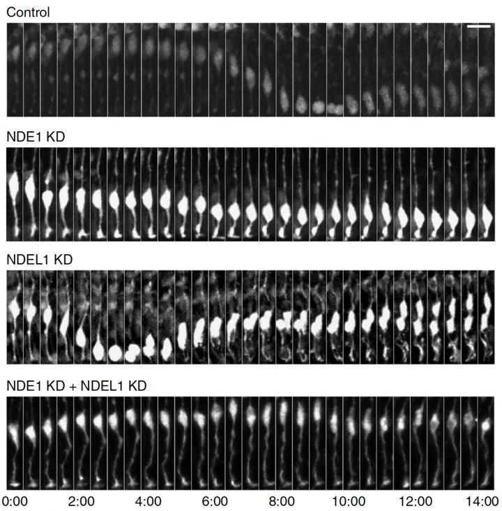 Live Imaging of Brain Slice Preparations