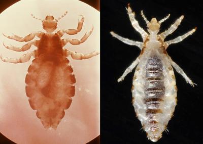 Head Louse and Body Louse