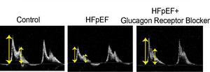 Potential new heart failure treatment