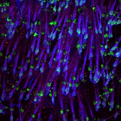 Stem Cells from Adult Mouse Epidermis; Sox4 Protein Maintains Tissue Homeostasis in These Cells