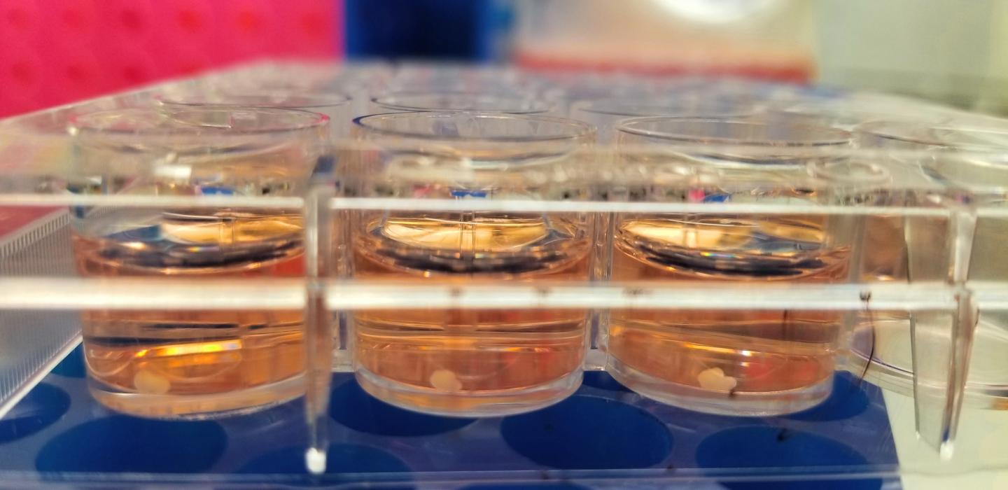 Oligocortical Spheroids