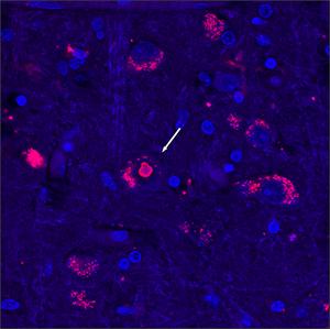 SCA4 brain tissue