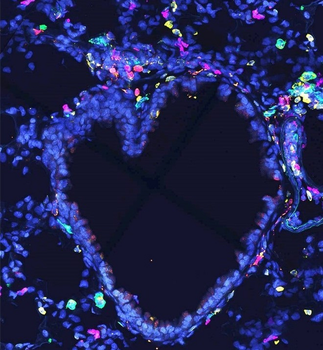 Immunostaining AM ILC2