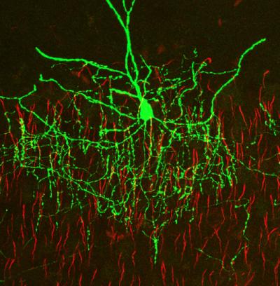 Chandelier Cells Are Master Circuit Breakers in the Brain