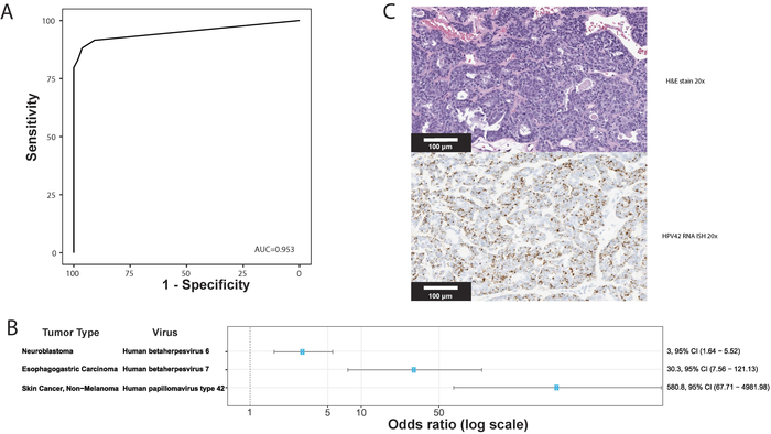 Validation of virus detection by the tumor profiling assay and novel virus associations