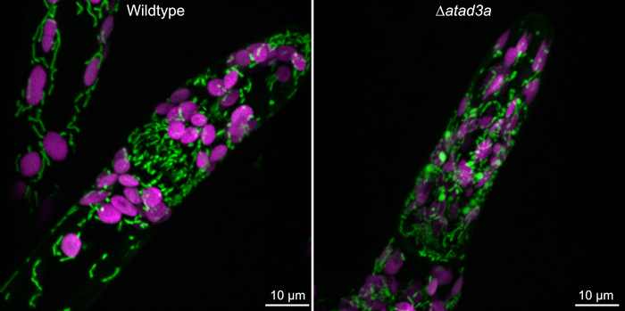 The mitochondria (green) and chloroplasts (pink) of the moss Physcomitrium patens. “Wildtype” is the control sample, while “atad3a” shows a mutant where ATAD3 has been disrupted, yielding enlarged, oddly shaped mitochondria.
