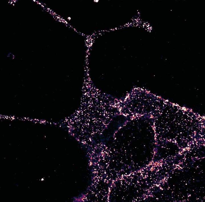 GLP1R Visualized in Insulin-Secreting Beta Cells at Super-Resolution (1 of 2)