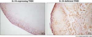 Effect of IL-34 on angiogenesis