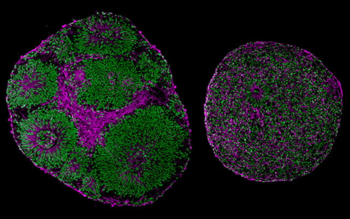 Brain Organoids, University of California San Diego