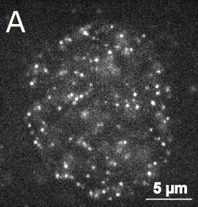 Image of a Human Nucleus, the Center of a Cell Where DNA is Stored