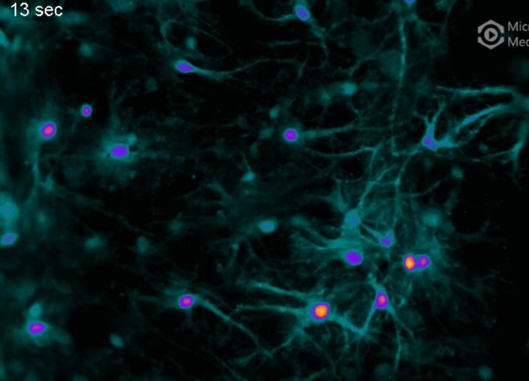DREADDS in mouse neurons