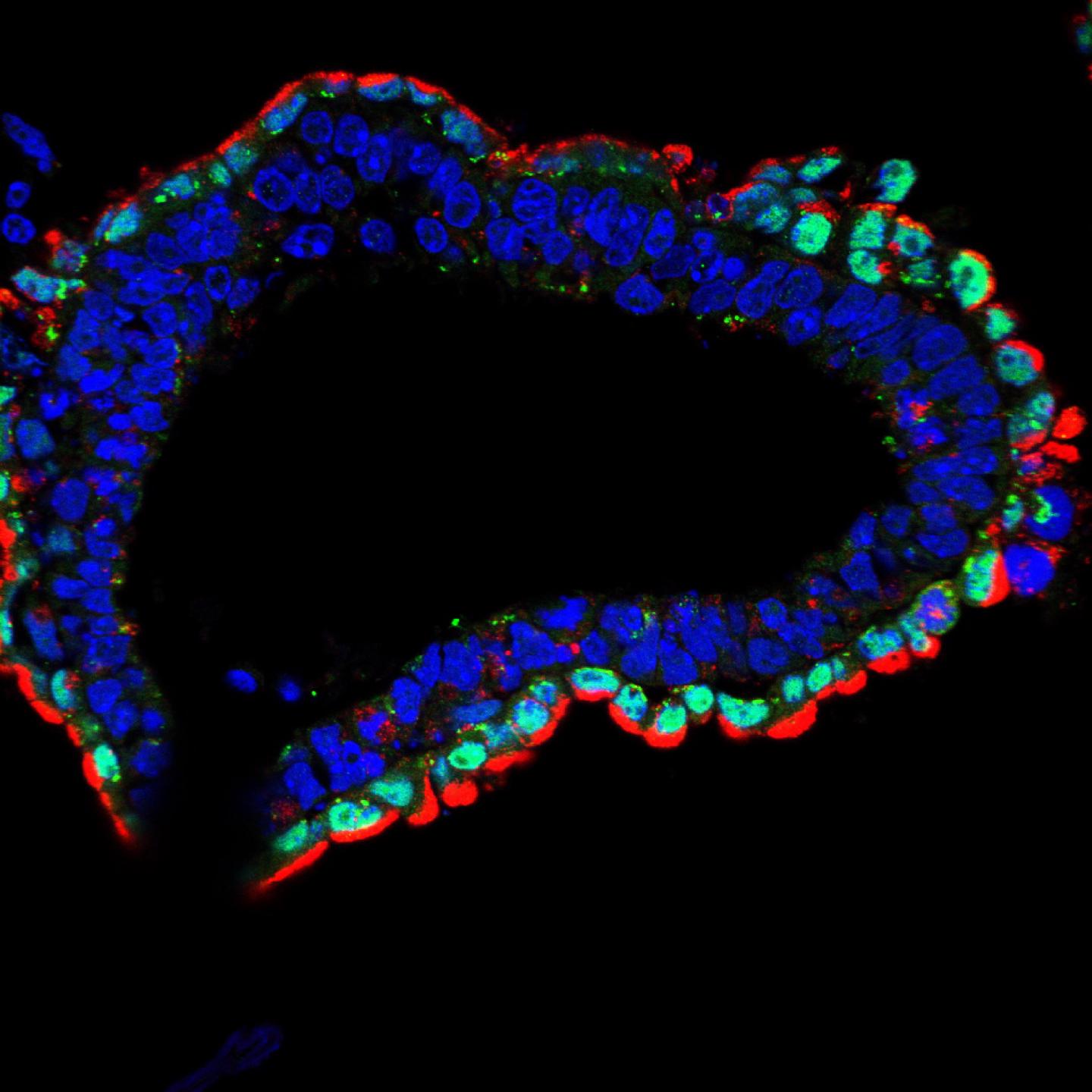 Salk Scientists Uncover How a Cell's 'Fuel Gauge' Promotes Healthy Development