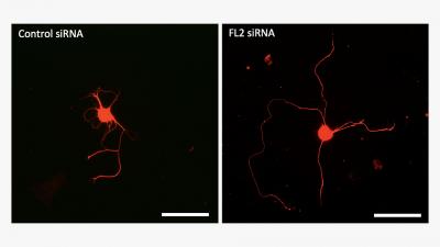 Neurons Cultured in Petri Dishes