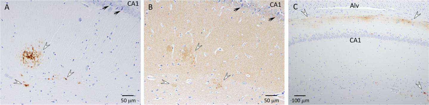Fig 3. Amyloid-&#946; Plaques in the Hippocampus of APP+PS1 Rats
