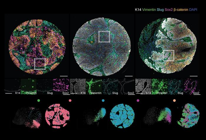 Patient-specific fingerprints