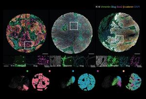 Patient-specific fingerprints