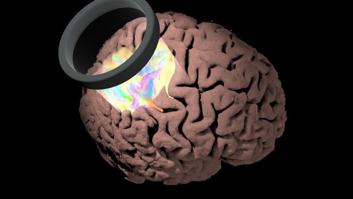 Illustration of brain stimulation