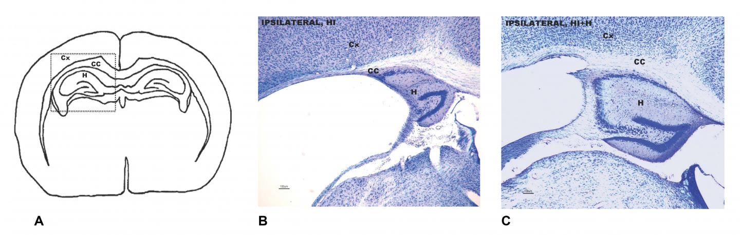 Sensory Stimuli Improves Brain Damage in Mouse Models of Preterm Birth