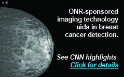 Mammography Image Using AIE Technology