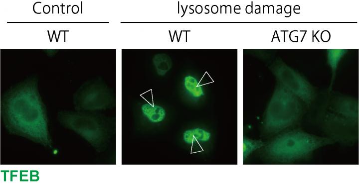 Figure 1. LC3 lipidation is essential for TFEB activation.