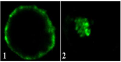 MHC-I in Uninfected and Infected Cells