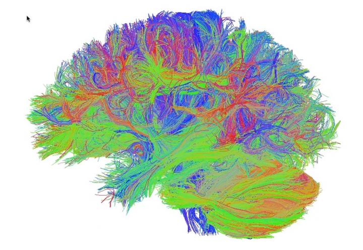 Whole Brain Reconstruction of the Human Structural Connectome