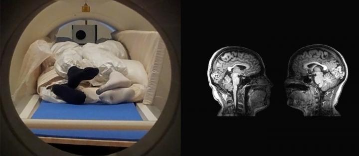 Two Person Together Mri Scans On Couples Investigates How Touching Is Perceived In The Brain 1274