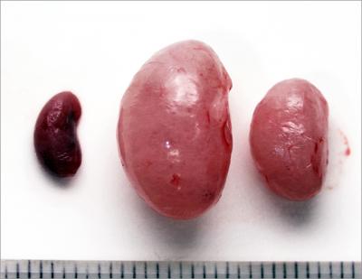 Kidneys
