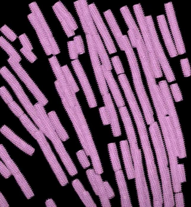 Cryo-electron tomography