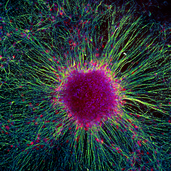 Cluster of neuronal cells colored for genes known to be expressed in brain cells