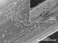 SEM Micrographs of the <em>S. aureus</em> Biofilm Formed on the Surgical Mesh Surface