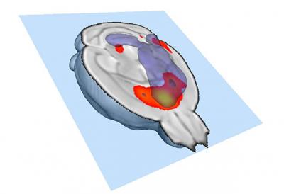 Making Your Brain Social