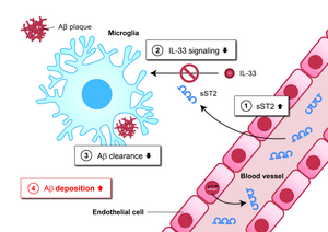 The diagram shows how increased sST2 levels in AD impair microglial clearance of amyloid pathology