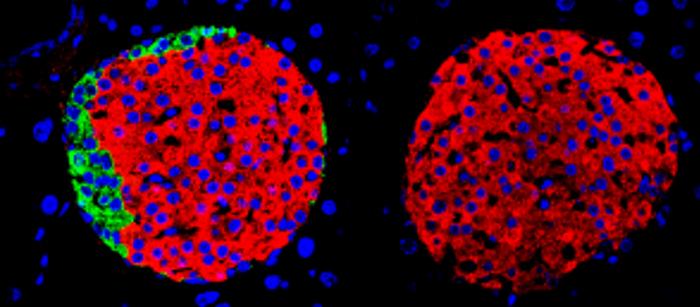 Insulin cells don’t need to team up