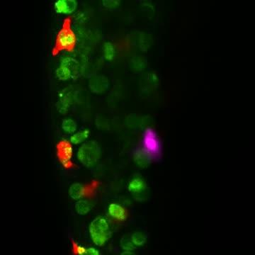 Visualising immune-cancer interactions