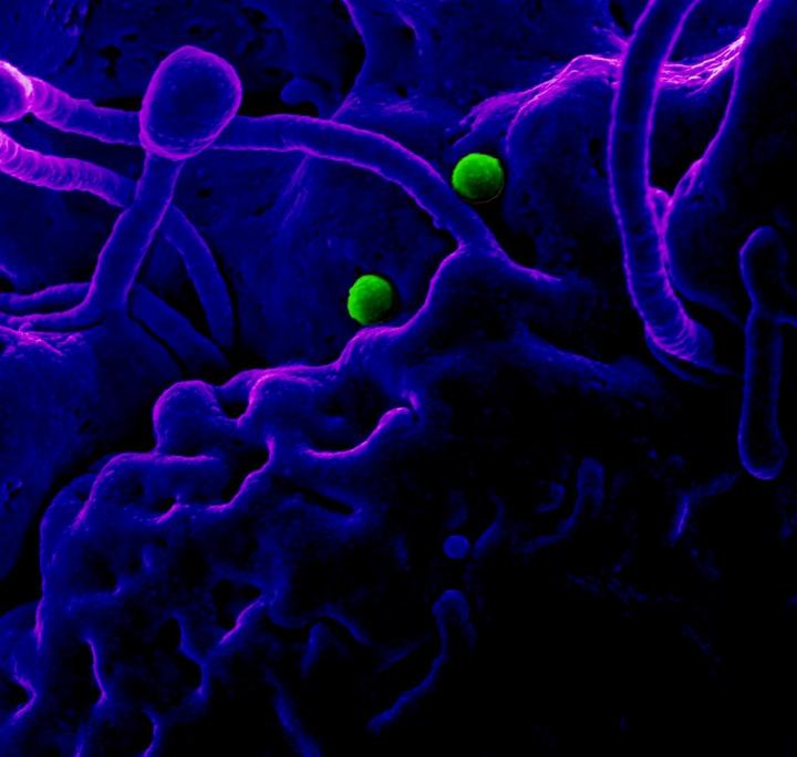 MERS-CoV Particles on Camel Epithelial Cells