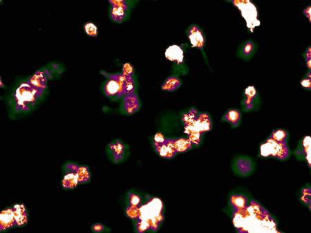 LUT on Il-1 Stained Cells