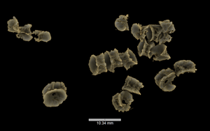 A micro-CT scan inside Eric's stomach