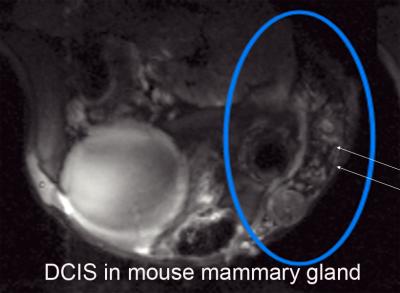DCIS in Mouse Mammary Gland