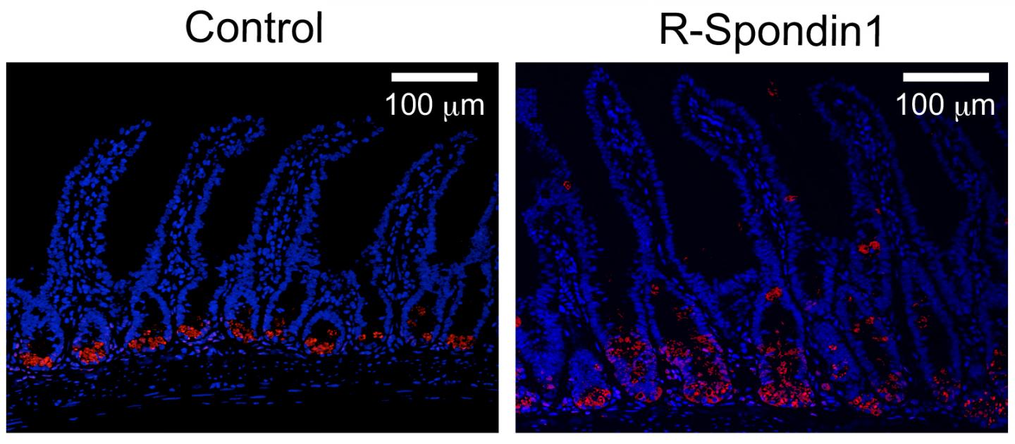 Increased Secretion of &#945;-defensin