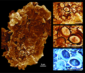 Microscopic plankton cell-wall coverings preserved as “ghost” fossil impressions, pressed into the surface of ancient organic matter (183 million years old).