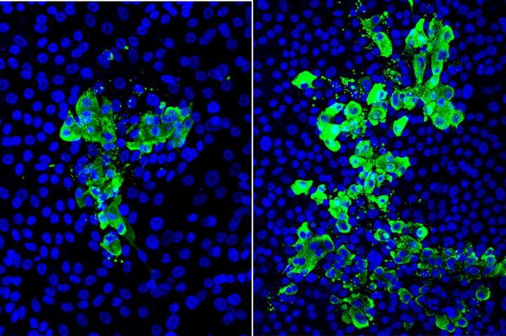 Microscopic images of human stem cell-derived airway tissue models